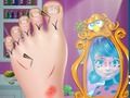 Hra Ladybug Foot Chirurgie 