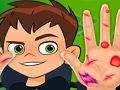 Hra Ben10 Hand Doctor