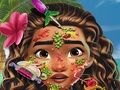 Hra Kožní lékař Moana 