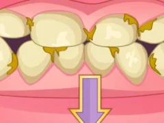 Hra Bad Teeth Makeover