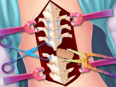Hra Anna Scoliosis Surgery