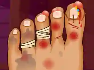 Hra Monster Foot Doctor