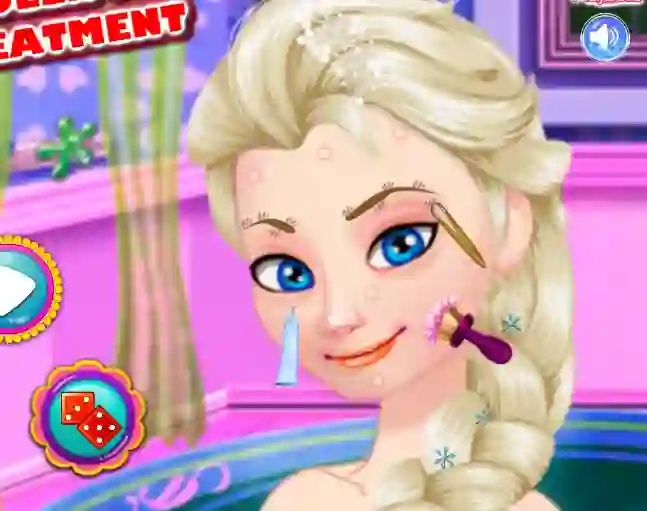 Hra Ice Queen Acne Treatment