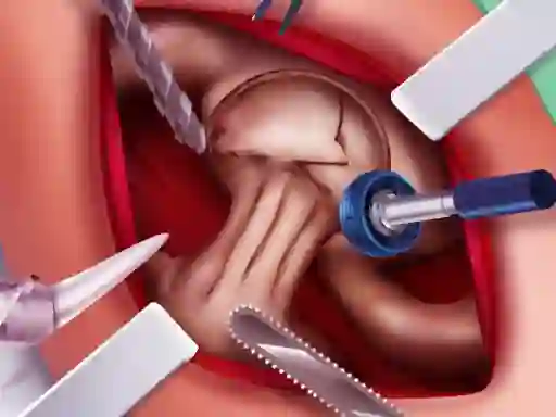 Hra Princess Hips Surgery