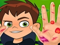 Hra Ben10 Hand Doctor